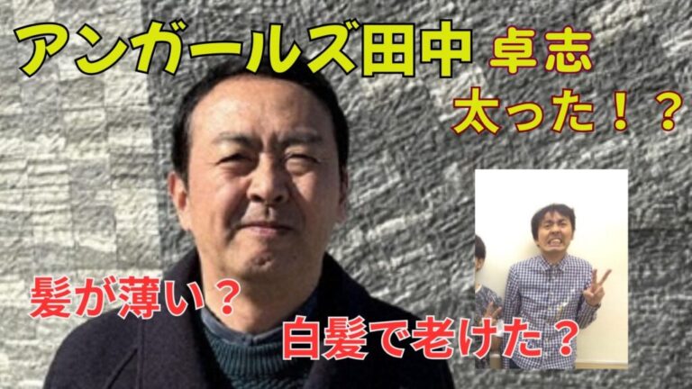 【画像比較】アンガールズ田中卓志は太った？現在は若い頃より髪が薄く白髪で老けた？